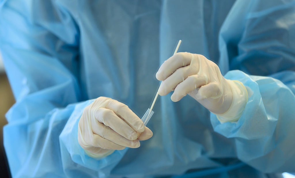 Ab dem 11. Oktober wird der bisher kostenfreie Coronatest für viele Menschen kostenpflichtig. Aber es gibt Ausnahmen.