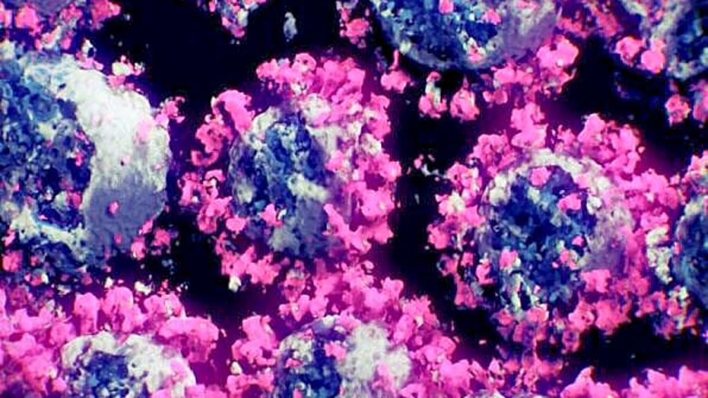 CoronaLage im Landkreis Wittenberg Auffälliges Ausbruchsgeschehen in