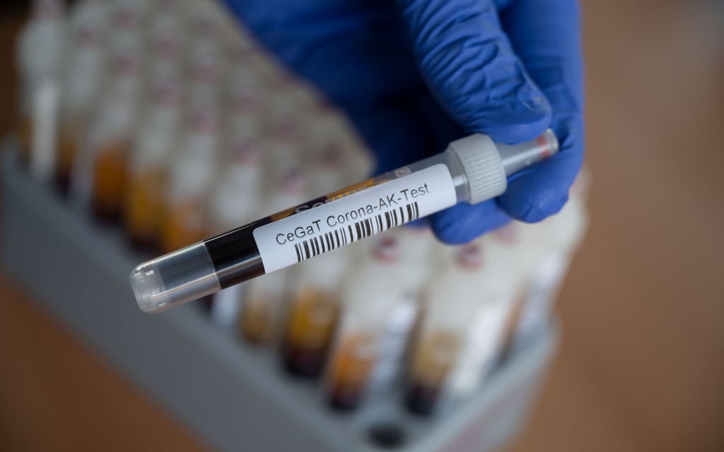 Coronatest