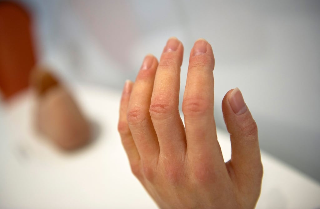 Aus Silikon hergestellte Prothesen für Finger und Hand können täuschend echt aussehen.