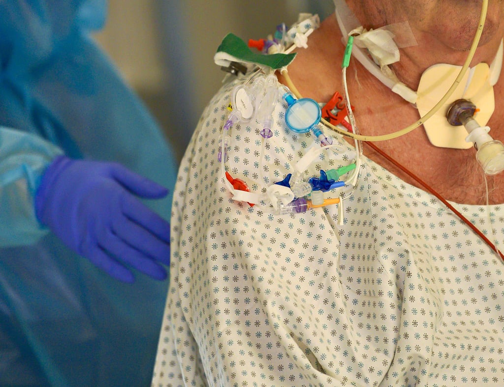 In den Ameos-Kliniken im Salzlandkreis werden derzeit 54 Covid-Patienten behandelt. Sieben von ihnen werden auf der Intensivstation behandelt und müssen beatmet werden.