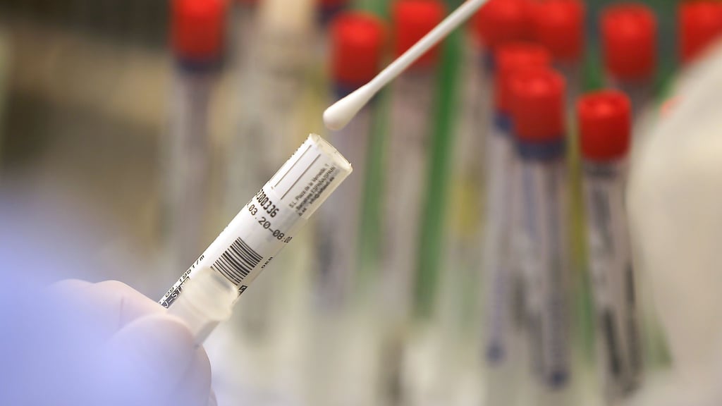Ein Abstrich wird in einem Labor auf das Coronavirus untersucht.