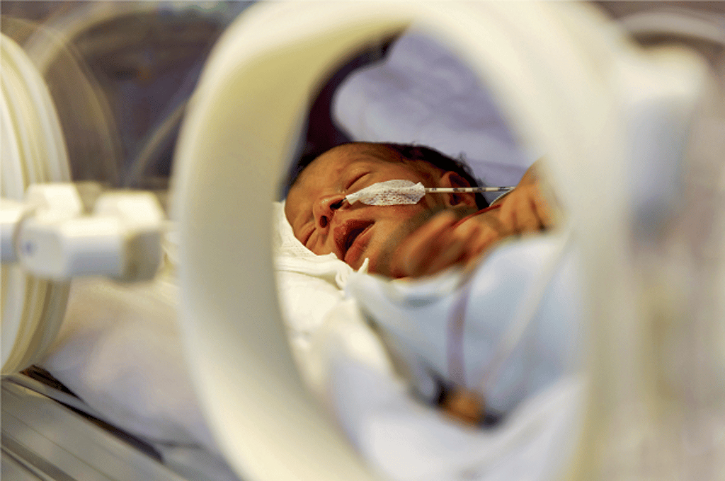 Baby im Inkubator: Mindestmengen tragen dazu bei, dass komplizierte Operationen und Behandlungen, wie z.B. bei Früh- und Neugeborenen, mit der nötigen Routine und Erfahrung durchgeführt werden.