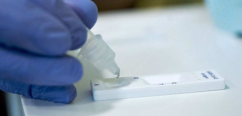 Um Bewohner von Pflegeeinrichtungen über die Weihnachtstage besuchen zu dürfen, ist ein aktueller und natürlich negativer Schnelltest für Besucher erforderlich.
