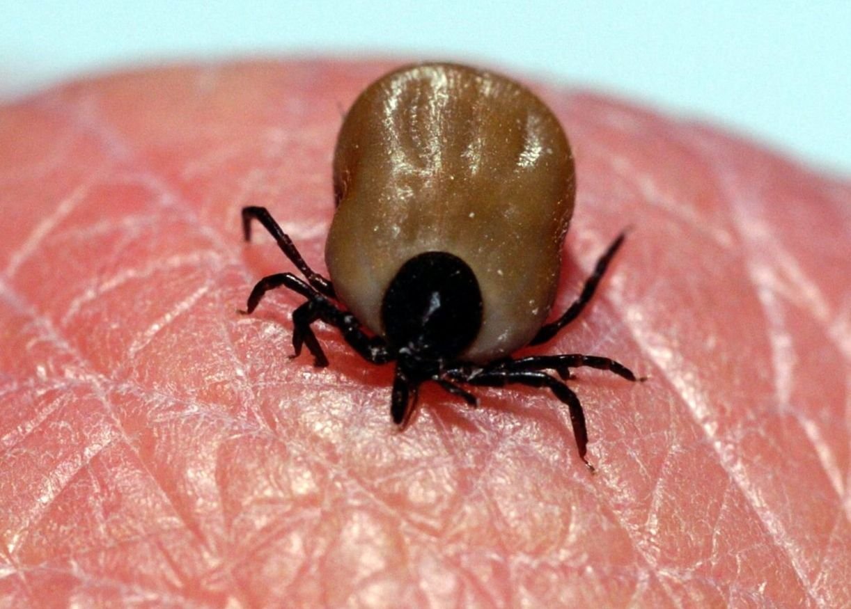 Eine Zecke auf der Haut eines Menschen. Zecken bohren sich mit Bewegungen ähnlich wie Brustschwimmer in die Haut von Menschen, um sich dort festzusaugen.