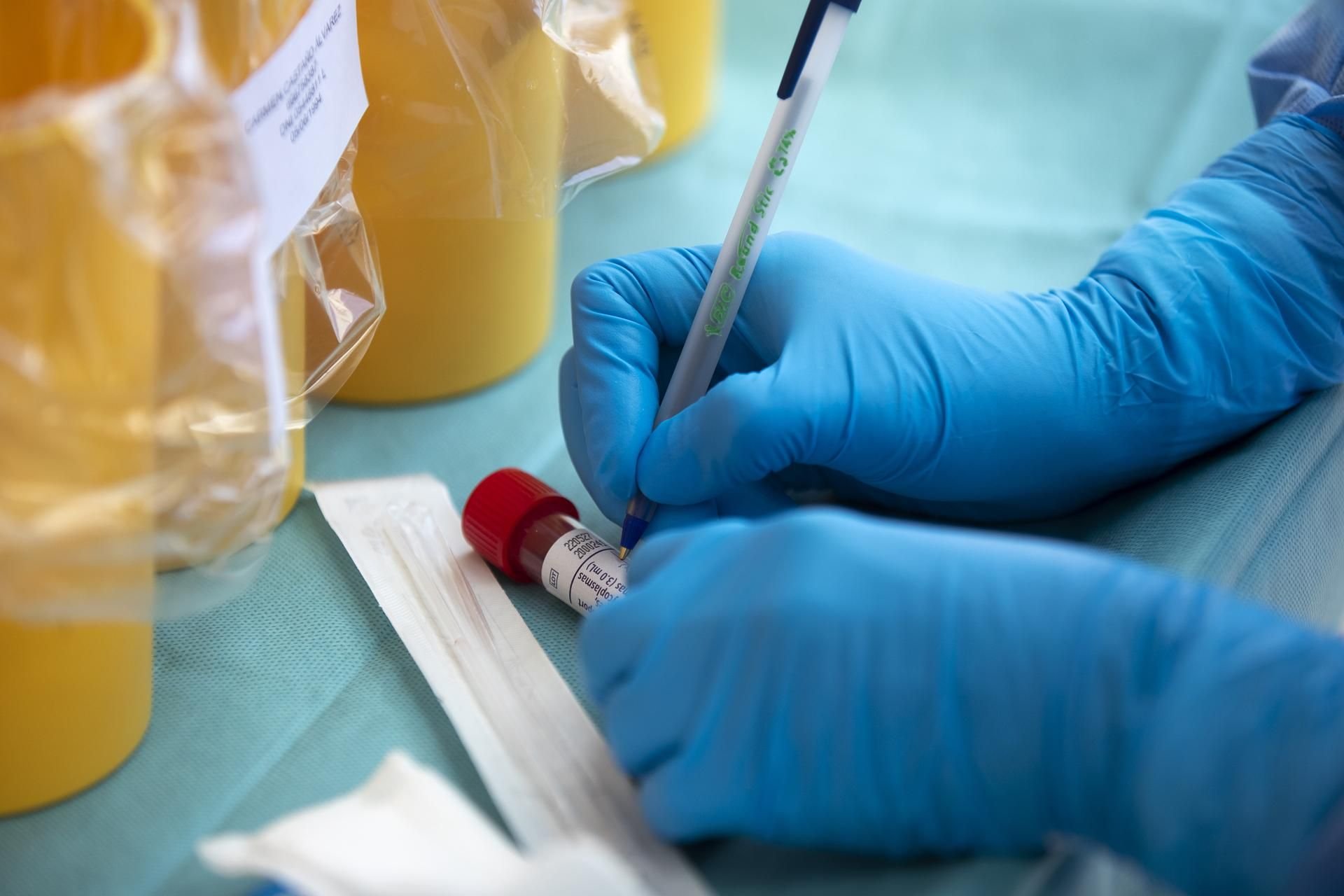 Die Gesundheitsämter haben bei der Nachverfolgung von Corona-Infektionen häufig noch Probleme.