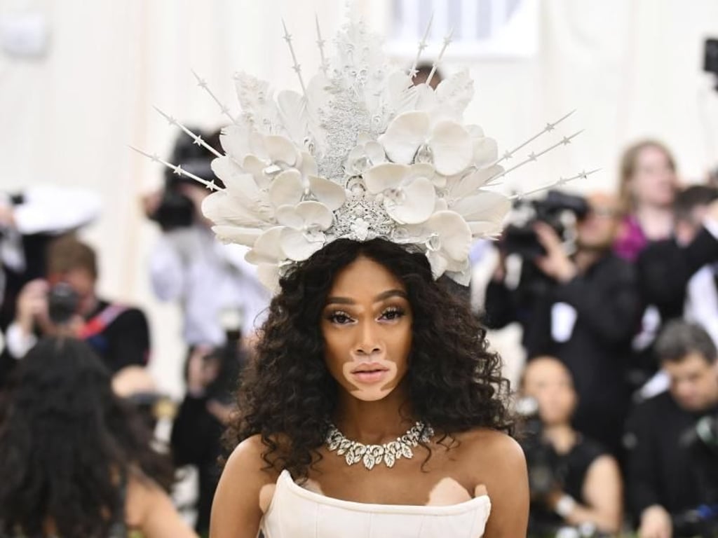 Model Winnie Harlow bei der «Met Gala» 2018. Foto: Charles Sykes