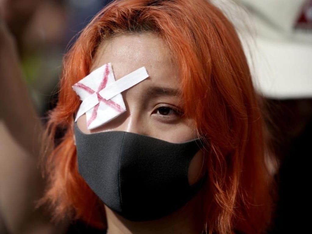 Eine junge Frau demonstriert gegen den von den Protestlern beklagten Gewalteinsatz der Polizei. Foto: Darryl Dyck/The Canadian Press/AP