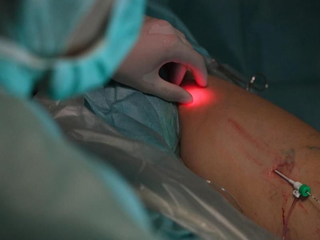Krampfadern können auch per Laser behandelt werden. Foto: Andrea Warnecke
