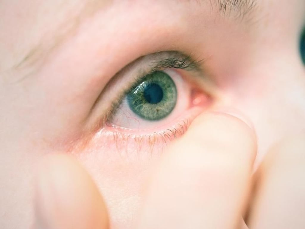 Da Bindehautentzündungen ansteckend sind, sollte man mit den Fingern besser nicht in das betroffene Auge fassen. Foto: Karolin Krämer