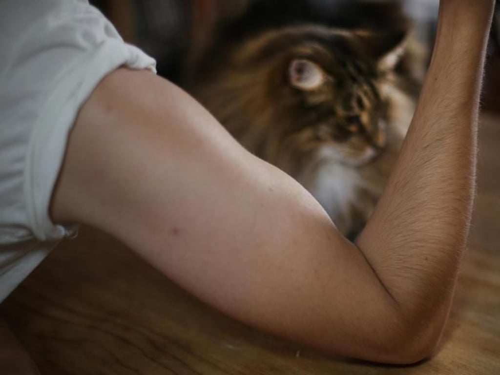 Fieser Kater: Manchmal schmerzen die Muskeln nach dem Training so heftig, dass man sich kaum noch rühren kann. Manch einem gibt Muskelkater aber erst das Gefühl, etwas getan zu haben. Foto: Ina Fassbender