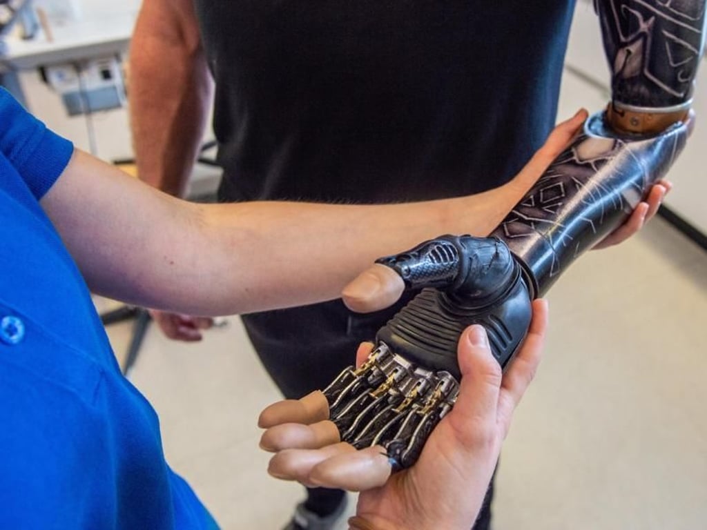 Orthopädietechnik-Mechaniker erklären den Patienten auch, wie sie ihre Hilfsmittel richtig handhaben. Luisa Richter lernt in der Ausbildung, wie das richtig geht. Foto: Caroline Seidel