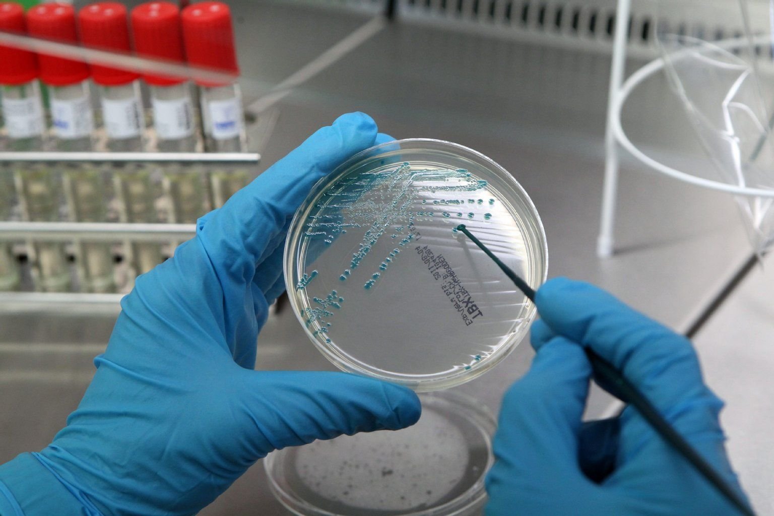Die große Mehrheit der Krankenhausinfektionen wird durch sensible Keime hervorgerufen - also durch solche, gegen die Antibiotika wirken. Multiresistente Keime bereiten der Medizinerin dennoch Kopfschmerzen.