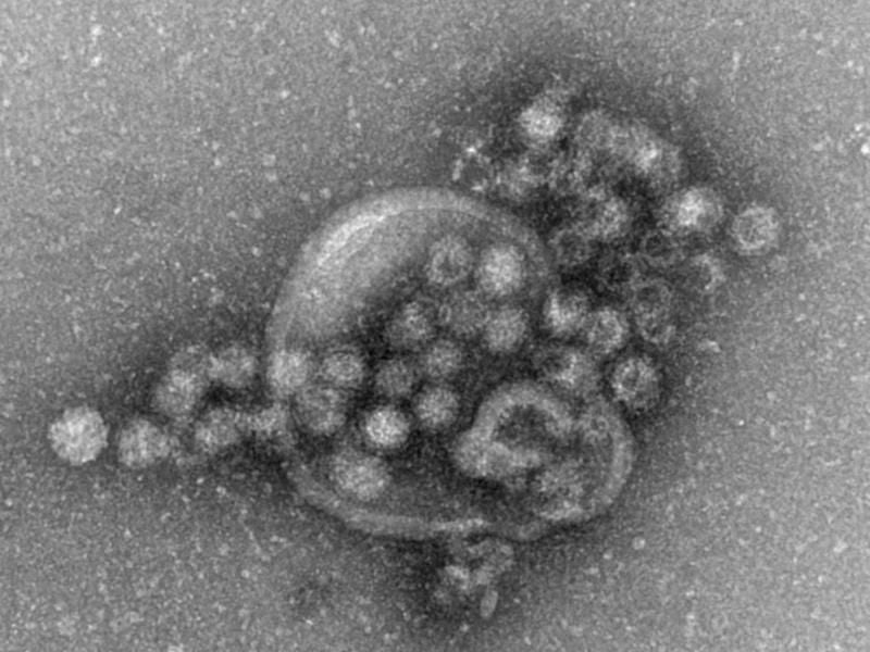 Auf zwei Kreuzfahrtschiffen haben sich Passagiere mit dem Norovirus angesteckt. Die Reisen wurden deshalb früher als geplant beendet.