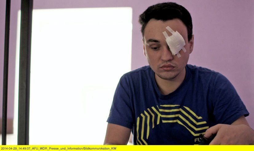 Seit einem Angriff von Schwulenhassern ist Dima auf dem linken Auge blind.