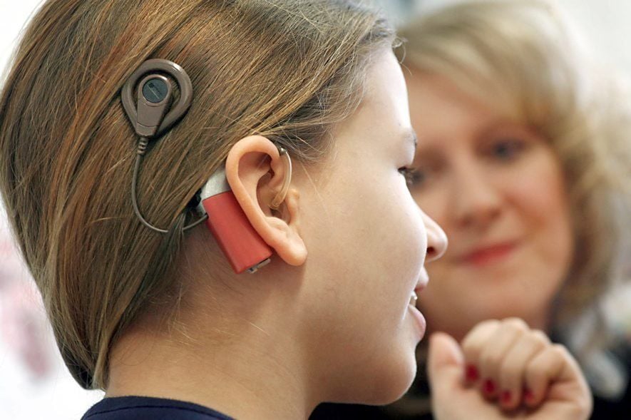 Ein Mädchen mit Cochlea-Implantaten: Der Sprachprozessor sowie die Sendespule, die außen am Kopf getragen werden, bleiben nach der OP sichtbar.