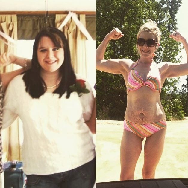 Der „Mom Bod“ ist das Gegenstück zum „Dad Bod“