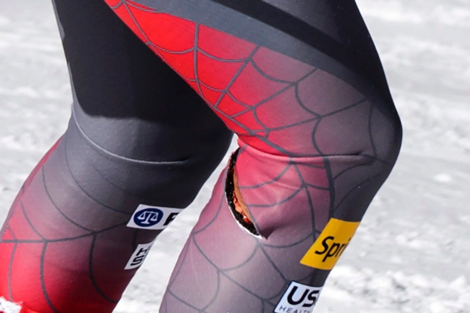 Eine tiefe Fleischwunde trug Bode Miller durch den Sturz davon.