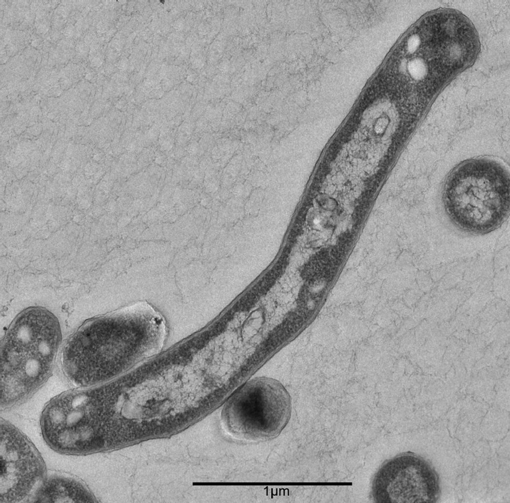 Der Tuberkulose-Erreger Mykobakterium Tuberkulosis, aufgenommen unter dem Elektronenmikroskop.