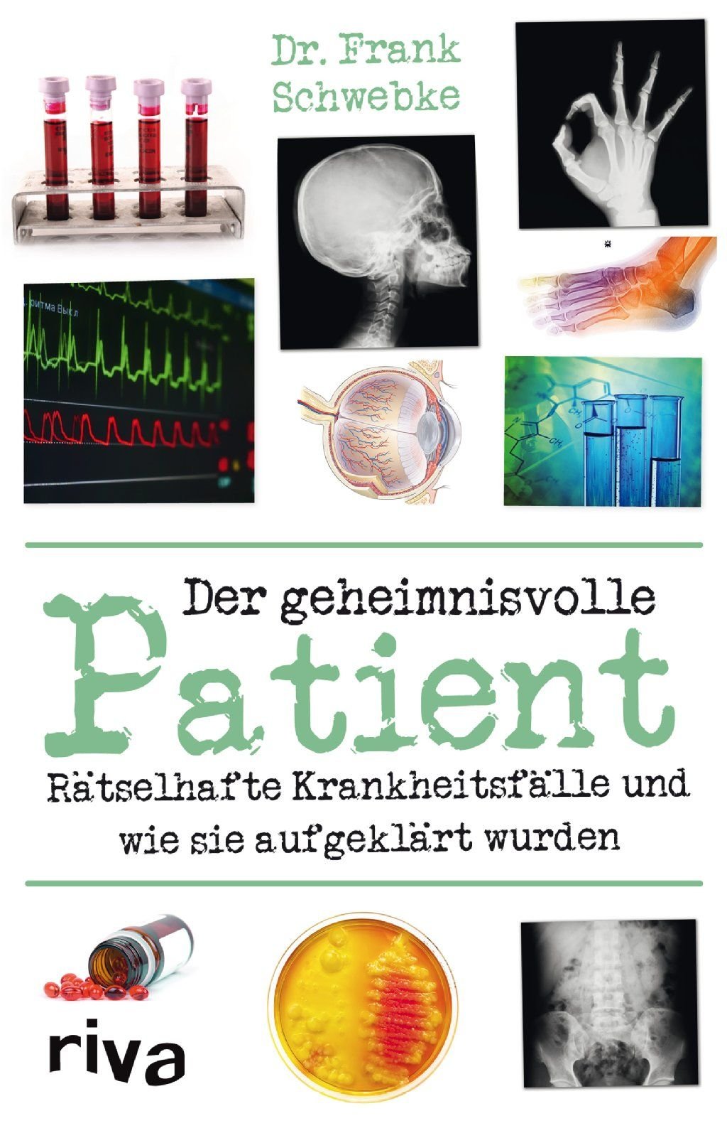 Dr. Frank Schwebke, Der geheimnisvolle Patient – Rätselhafte Krankheitsfälle und wie sie aufgeklärt wurden, 224 Seiten, 16,99 Euro.
