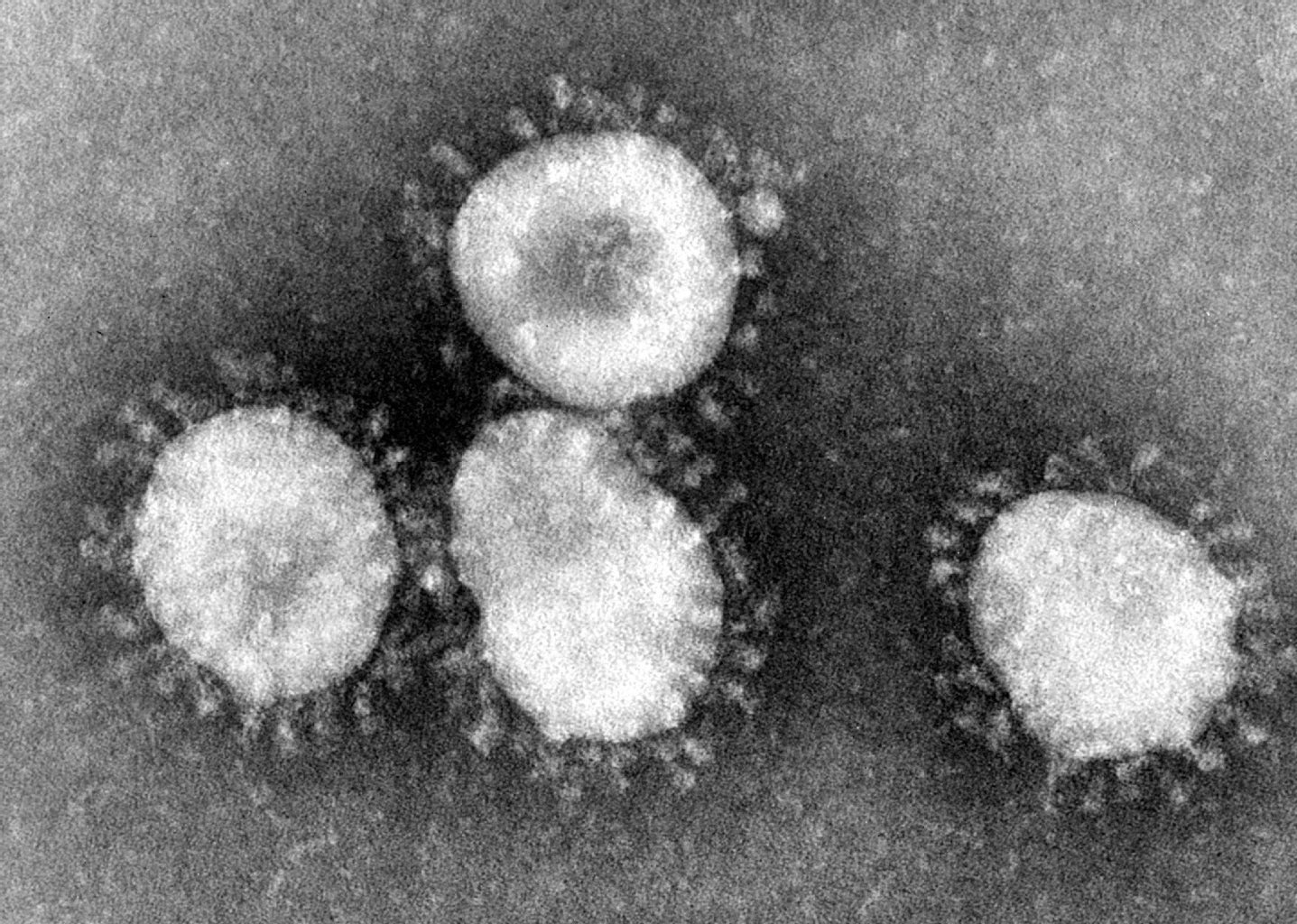 Ein Coronavirus unter dem Mikroskop.