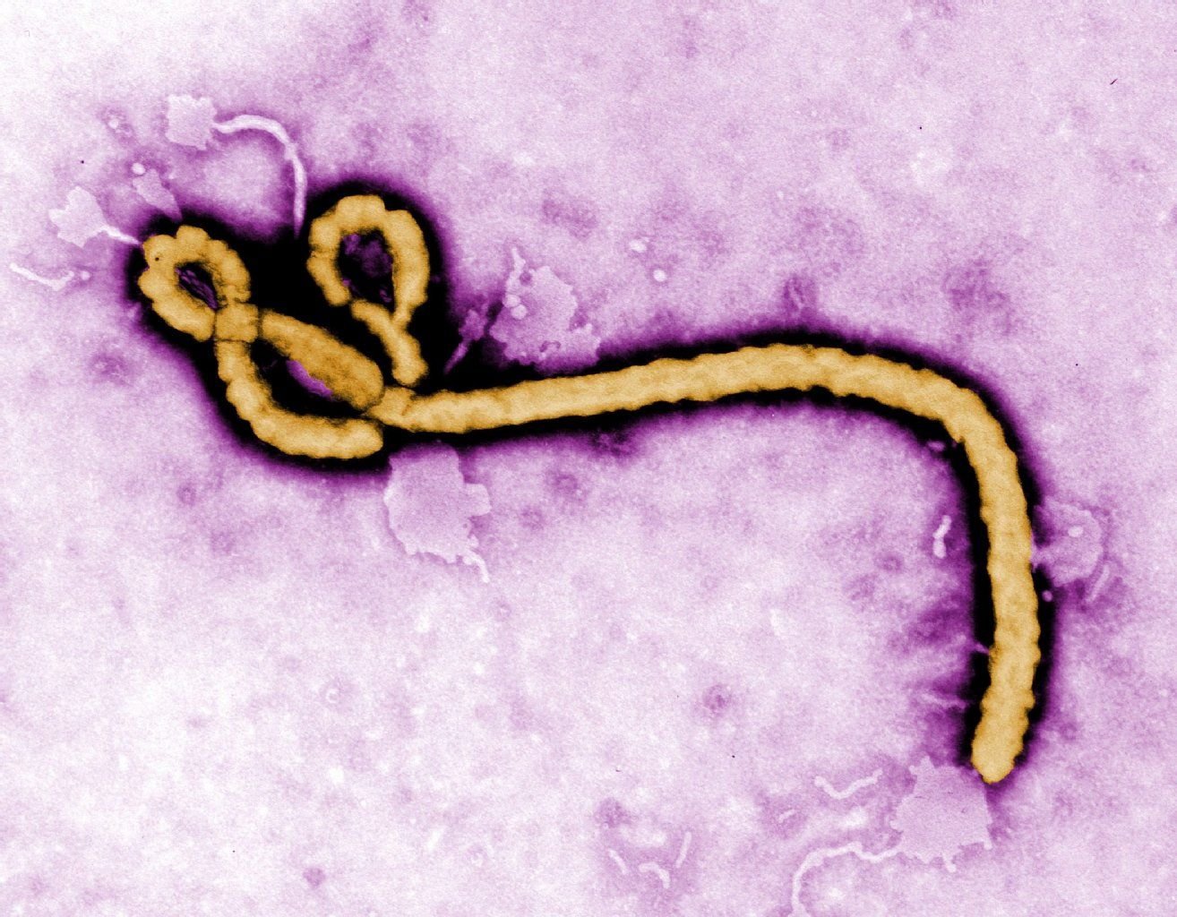 Das Ebola-Virus unter dem Mikroskop