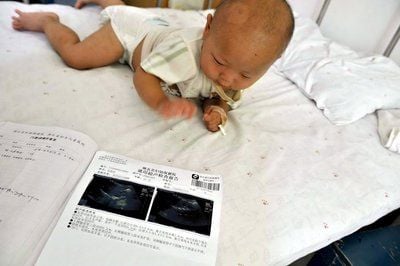 Der zehnmonatige Zhang Yuxuan liegt neben Ultraschallaufnahmen auf einem Krankenbett. Ärzte suchen nach Nebenwirkungen durch Melamin-verseuchte Babynahrung. (Foto: dpa)