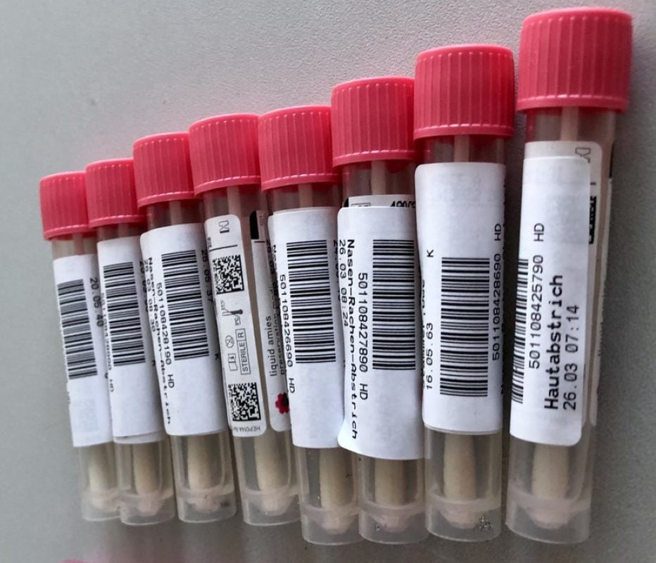Röhrchen mit Proben, die auf den Corona-Virus getestet werden.