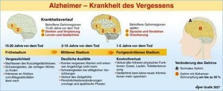 Verlauf der Krankheit (Grafik: dpa)