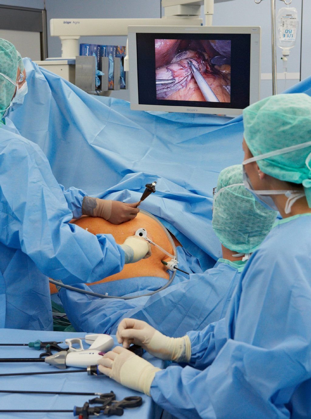 Die meisten Patienten haben schon unzählige Diäten hinter sich, bevor sie sich für eine Operation entscheiden.