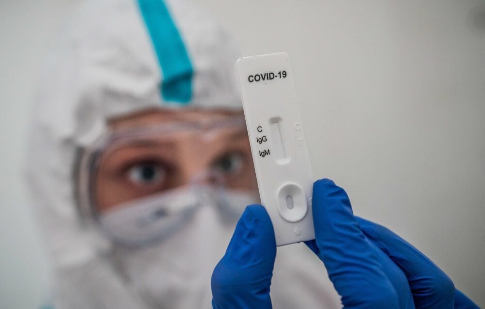 Die sogenannten Antigen-Tests zeigen das Ergebnis ähnlich wie bei einem Schwangerschaftstest an.