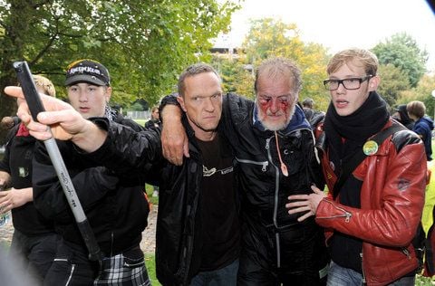 Zwei Männer stützen am Donnerstag im Schlossgarten in Stuttgart einen verletzten Mann. (FOTO: DPA)