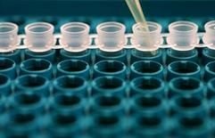 Mit einer Speichelprobe kann in von 24 Stunden die Vaterschaft geklärt werden. (Foto: dpa)