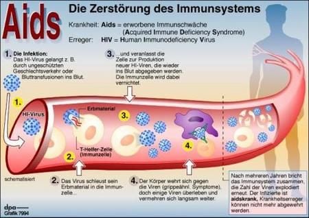 Informationen zur Immunschwäche Aids (Grafik: dpa)