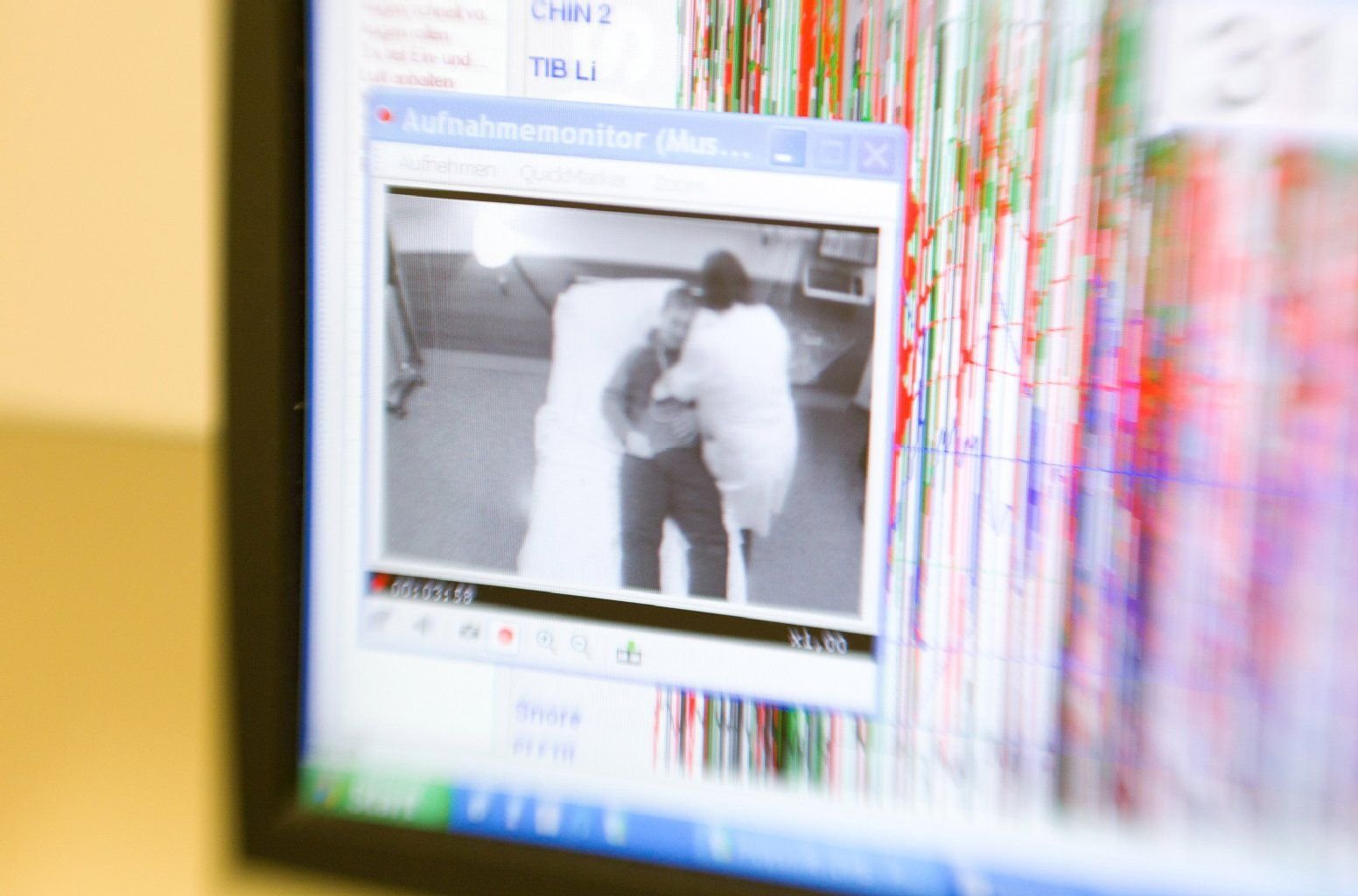 Der Schlaf der Narkolepsie-Patienten wird im Schlaflabor auf einem Monitor überwacht.