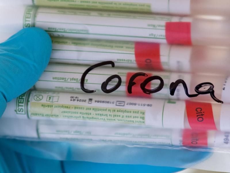 Proben für Corona-Tests werden untersucht. Foto: Hendrik Schmidt/dpa-Zentralbild/ZB/Symbolbild