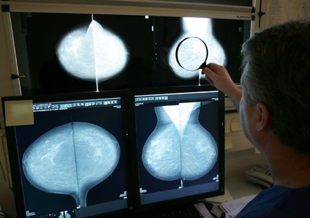 Bei der Mammographie wird die Brust auf Krebs untersucht. In Sachsen Anhalt haben die Früherkennungsuntersuchungen allerdings während der Corona-Pandemie nachgelassen. Symbolbild: