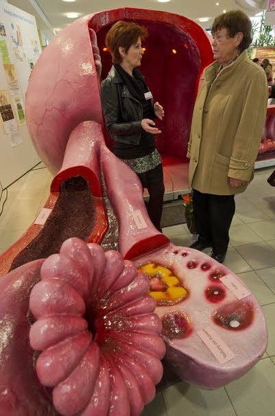 Expertin Sabine Fischbach erklärt Renate Spatek das Gebärmutter-Modell.