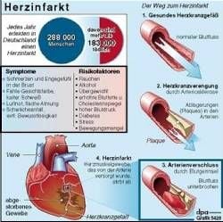 Herzinfarkt