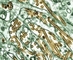 Ein Aufnahme durch ein elektronisches Mikroskop zeigt den Grippe-Virus H5N1 (braun). (Foto: ddp)