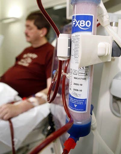 Patient bei der Dialyse