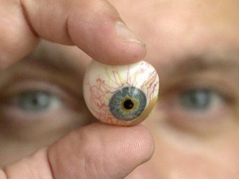 Ein Mann hält ein Glasauge in der Hand. Ein Mann aus Sangerhausen hat kein neues Rezept für seine Prothese bekommen.