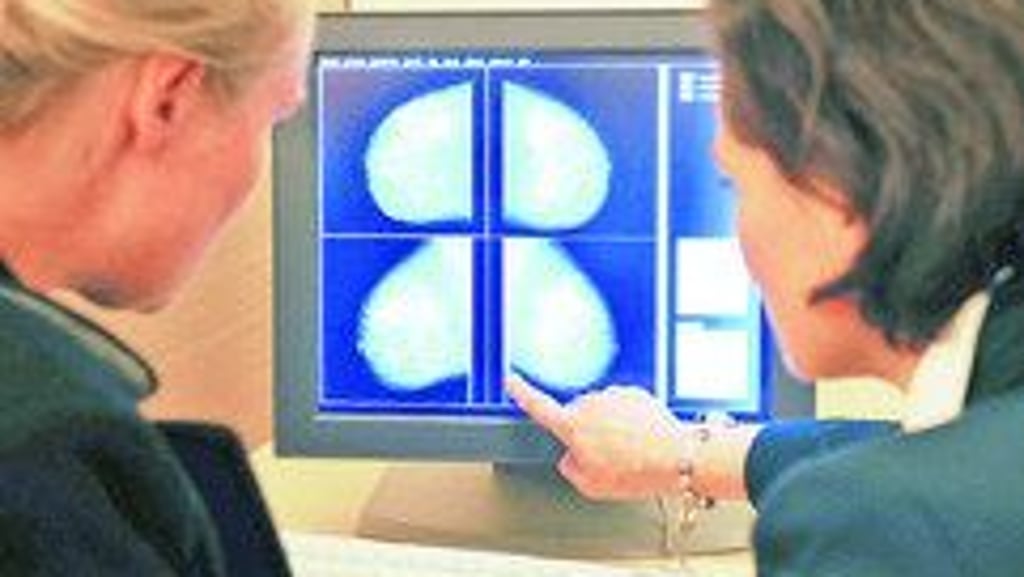 MammographieScreening MammographieScreening Befund im Brustgewebe