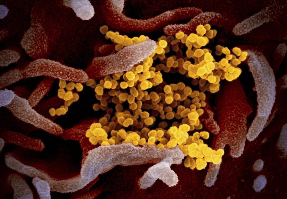 Das neuartige Corona-Virus unter dem Mikroskop.