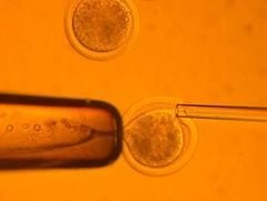 Undatierte Aufnahme des Wissenschaftsmagazin «Science» zeigt das Übertragung der Körperzelle von einer Frau in eine entkernte Eizelle derselben Spenderin. Daraus habe sich ein Embryo entwickelt, dem auf einer frühen Entwicklungsstufe Stammzellen entnommen worden seien, die sich zu allen Zelltypen eines Körpers bilden können. Bei diesem Experiment haben Forscher in Südkorea nach eigenen Angaben einen menschlichen Embryo geklont und daraus Stammzellen zur therapeutischen Anwendung gewonnen. Das berichtete die südkoreanische Nachrichtenagentur Yonhap am Donnerstag (12.02.2004) unter Berufung auf das Team um den Tiermediziner Hwang Woo Suk von der Seouler Nationaluniversität. Durch diese Methode des so genannten therapeutischen Klonens hoffen Wissenschaftler in aller Welt Stammzellen gewinnen zu können, die zur Heilung schwer kranker Menschen eingesetzt werden können. (Foto: dpa)
