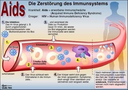 Infektion durch Aids-Viren (Grafik: dpa)