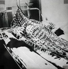 Die Reproduktion, aufgenommen in Leipzig im sächsischen Psychiatriemuseum, zeigt auf einer historischen Aufnahme ein Netz, mit dem Patienten ans Bett fixiert wurden. (Foto: ddp)
