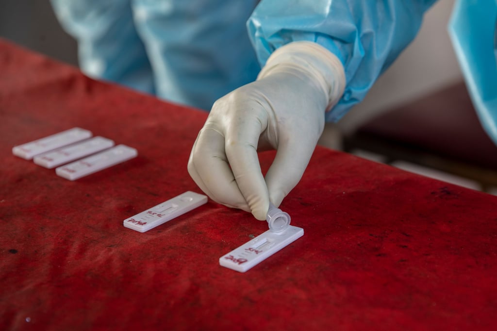 Ein Mitarbeiter des Gesundheitswesen testet eine Nasenabstrichprobe auf das Coronavirus.