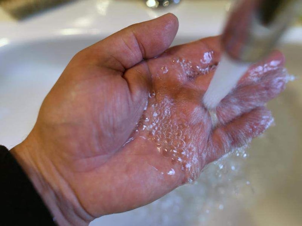 Bei kleineren Verbrennungen sollte man die Wunde 10 Minuten unter laufendes Wasser halten. Foto: Ralf Hirschberger