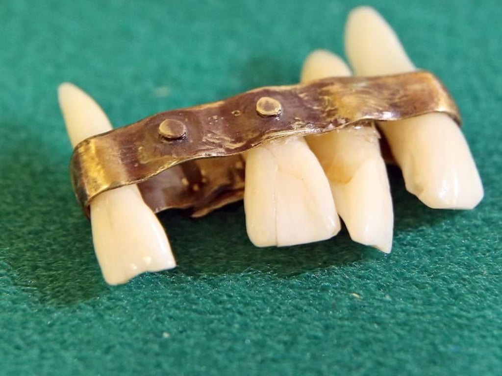 Manche Stücke im Dentalmuseum sind mehr als 2500 Jahre alt - so auch dieser etruskische Zahnersatz mit einem Goldband und eingenieteten Zähnen aus der Zeit um 500 v. Chr. Foto: Jan Woitas